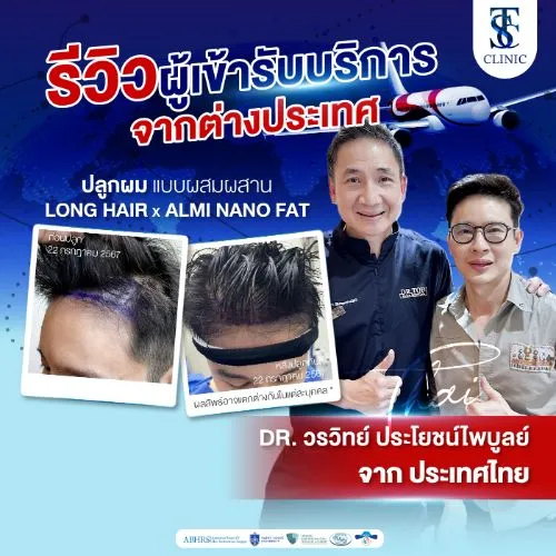 รีวิวการปลูกผมและการรักษาคนไข้จริง | THE SKIN CLINIC