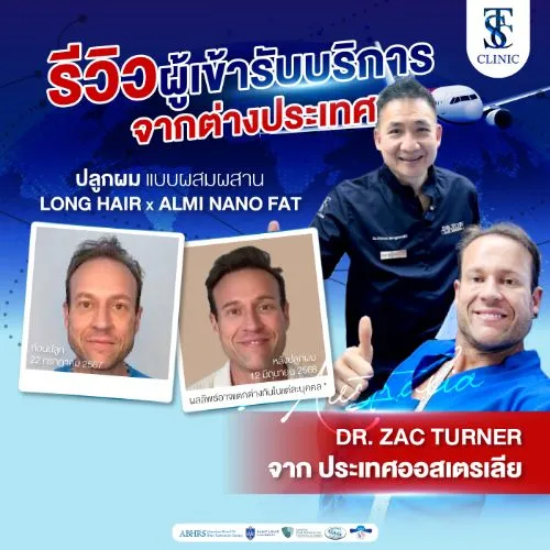 รีวิวการปลูกผมและการรักษาคนไข้จริง | THE SKIN CLINIC