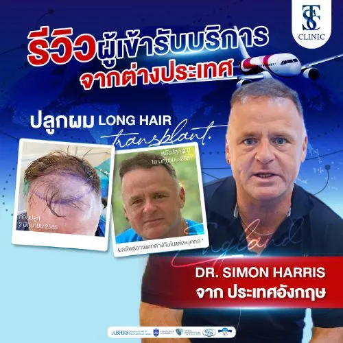 รีวิวการปลูกผมและการรักษาคนไข้จริง | THE SKIN CLINIC