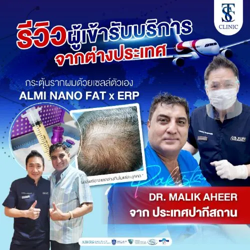 รีวิวการปลูกผมและการรักษาคนไข้จริง | THE SKIN CLINIC