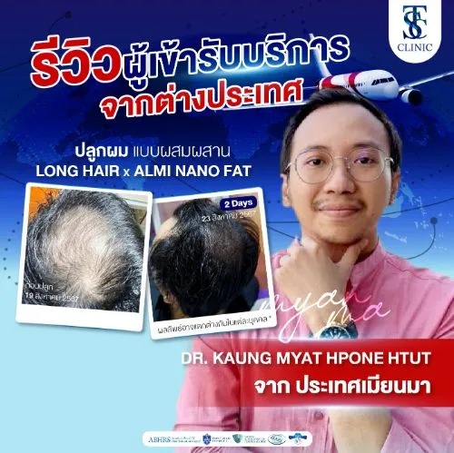 รีวิวการปลูกผมและการรักษาคนไข้จริง | THE SKIN CLINIC